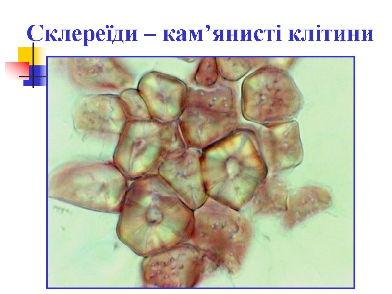 Склереїди – кам’янисті клітини